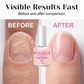 💅 Aanbieding 2026 — Meer dan 67.000 verkocht! ✨ ✨Koop 1, krijg 1 gratis✨ Keratine nagelversterker & -crème – Herstelt & geeft een glanzende finish 🌟